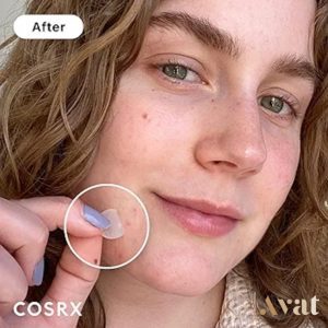 پچ ضد جوش فوری پیمپل مستر کوزارکس | Cosrx Acne Pimple Patch