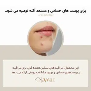 آمپول ترمیم کننده ماداگاسکار سنتلا اسکین 1004 | SKIN1004 MADAGASCAR CENTELLA ASIATICA 100 AMPOULE