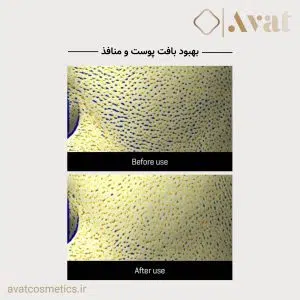 4-سرم رتینول سام بای می