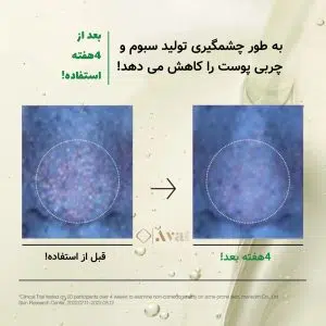 پاک ‌کننده روغنی آنوا