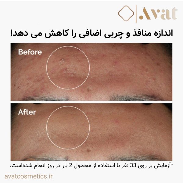 سرم نیاسینامید اوردینری