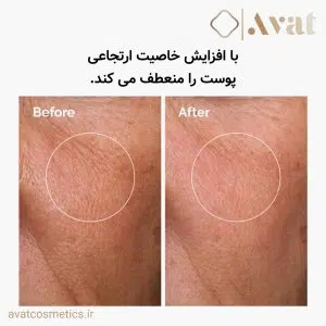 سرم هیالورونیک اسید اوردینری