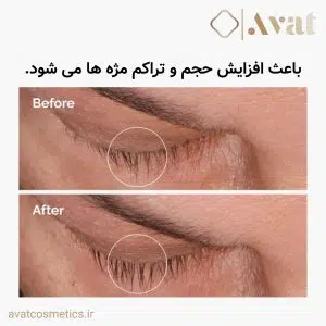 سرم تقویت مژه و ابرو اوردینری