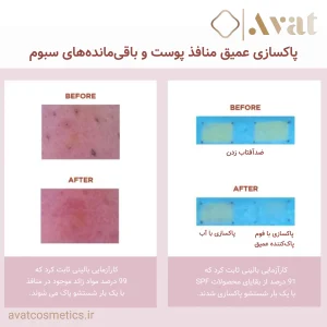 شوینده کنترل چربی و منافذ پوست سنتلا اسکین 1004
