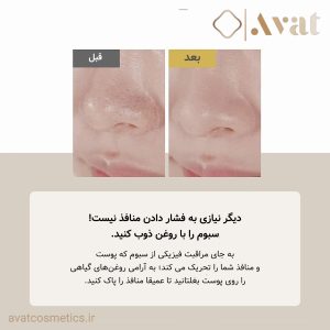 آبرسانی و تغذیه پوست با CENTELLA SKIN 1004 Light Cleansing Oil