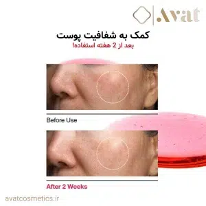 Anua Niacinamide 10% + TXA 4% Serum، پوستی شفاف و درخشان