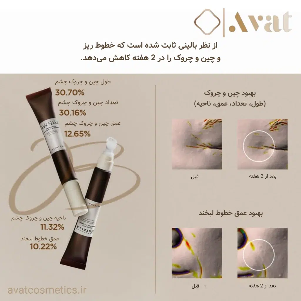 کرم دور چشم پروبیوسیکا سنتلا اسکین 1004، ترکیبی ایده‌آل برای مراقبت روزانه