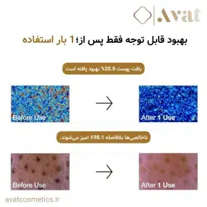 4. پودر پاک کننده آنزیم برنج آنوا