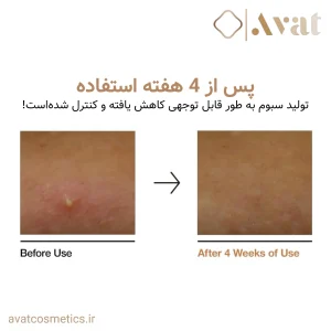 4.تونر برنج آنوا