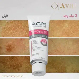 کرم ضد لک دپی وایت ACM مناسب درمان تخصصی لک‌های هورمونی و ناشی از آفتاب