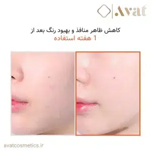 ISNTREE Hyper Niacinamide 20 Serum، کنترل چربی و کاهش منافذ
