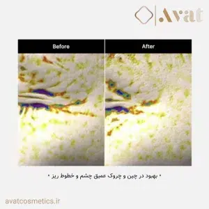 مراقبت تخصصی از پوست حساس اطراف چشم با MEDICUBE Deep Lifting Peptide Eye Cream