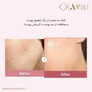 کرم مرطوب‌کننده MEDICUBE با ترکیب PDRN و هیالورونیک اسید، راه‌حل حرفه‌ای برای پوست آسیب‌دیده