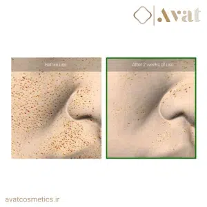 ترمیم سریع‌تر بافت پوست با سرم ریدل شات ۱۰۰ وی‌تی