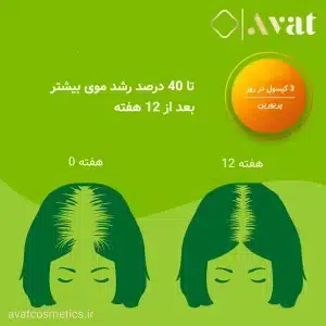 کمک به رشد مو با کپسول Supradyn PRIORIN