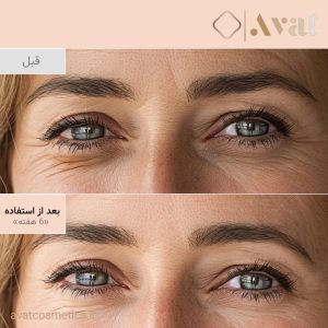 ترمیم پوست حساس اطراف چشم با Revive Eye Serum
