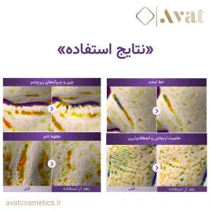 جذب سریع و آبرسانی عمقی با اسنس بایولیفتینگ نامبوزین