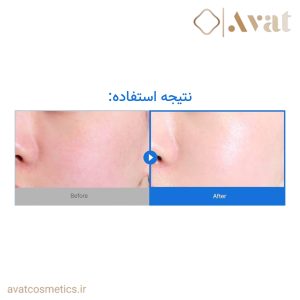 کرم مرطوب کننده سرامید ایلیون