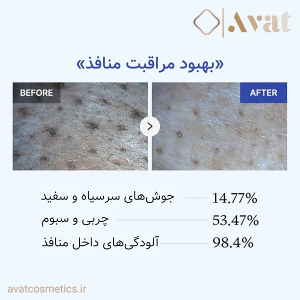 ماسک کنترل منافذ زیرو مدیکیوب