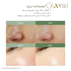 پاک کننده سریع سبوم دکتر آلتیا