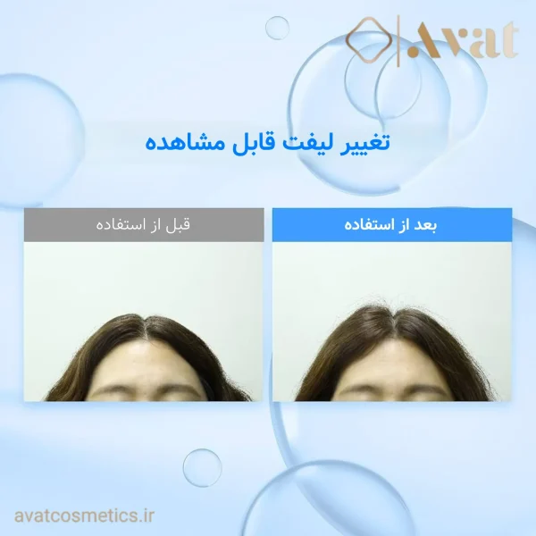 شامپو حجم دهنده هیالورون کندال