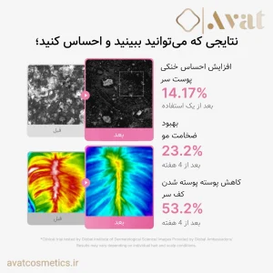 سرم کف سر رزماری و PDRN مدیکیوب