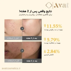 سرم کوجیک اسید مدیکیوب