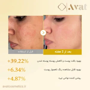 تونر کوجیک اسید مدیکیوب