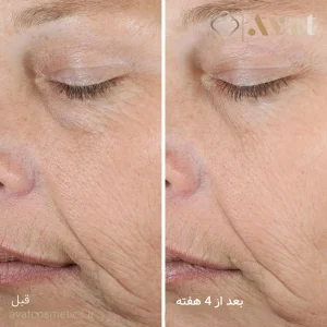 سرم Dewy تاچا