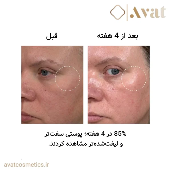 سرم رتینول اینکی لیست