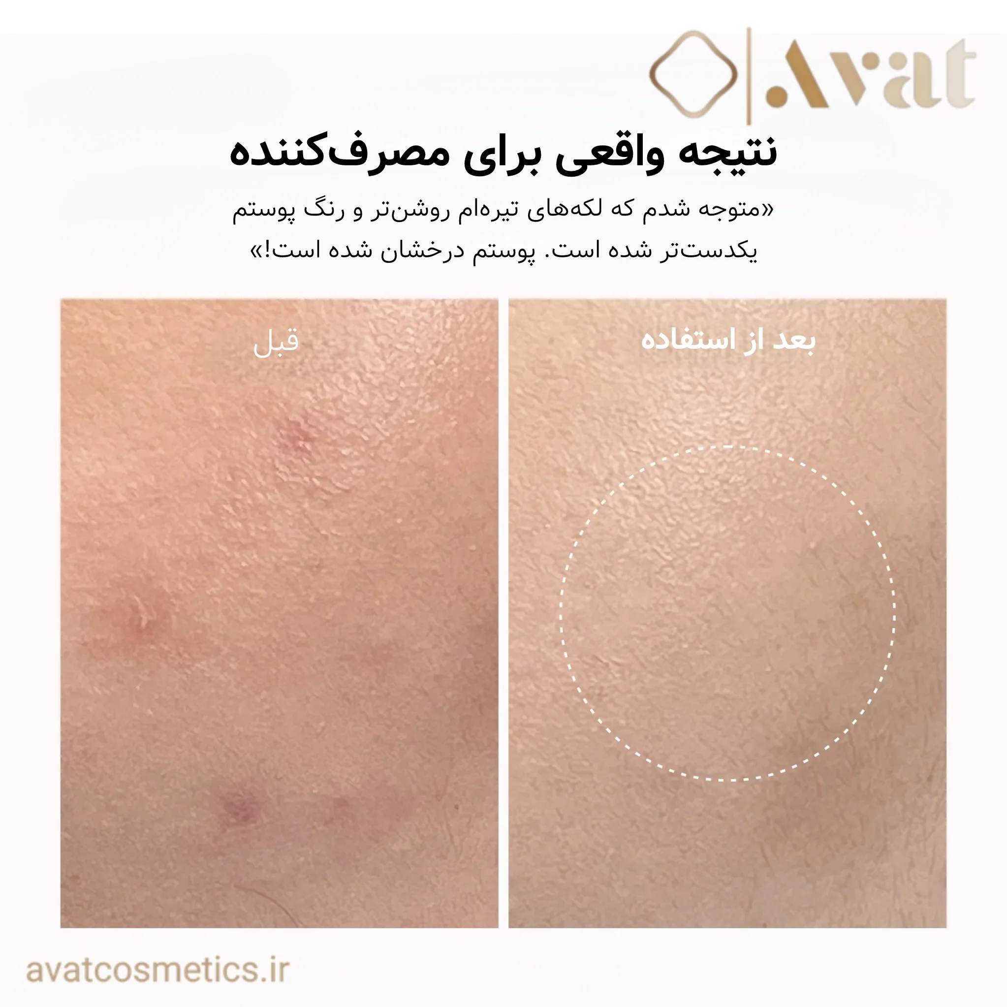 بوستر شات ترانگزامیک اسید آرنسیا