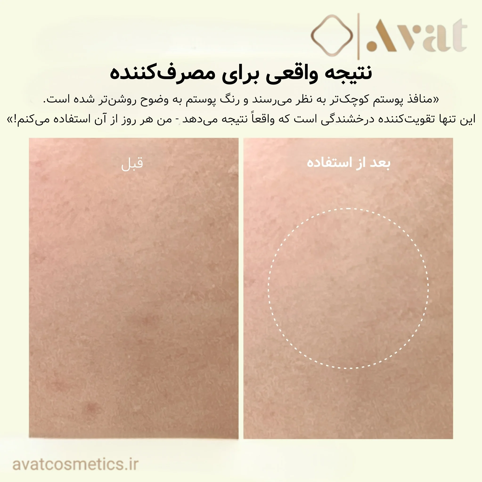 اسنس ویتامین سی و گلوتاتیون آرنسیا