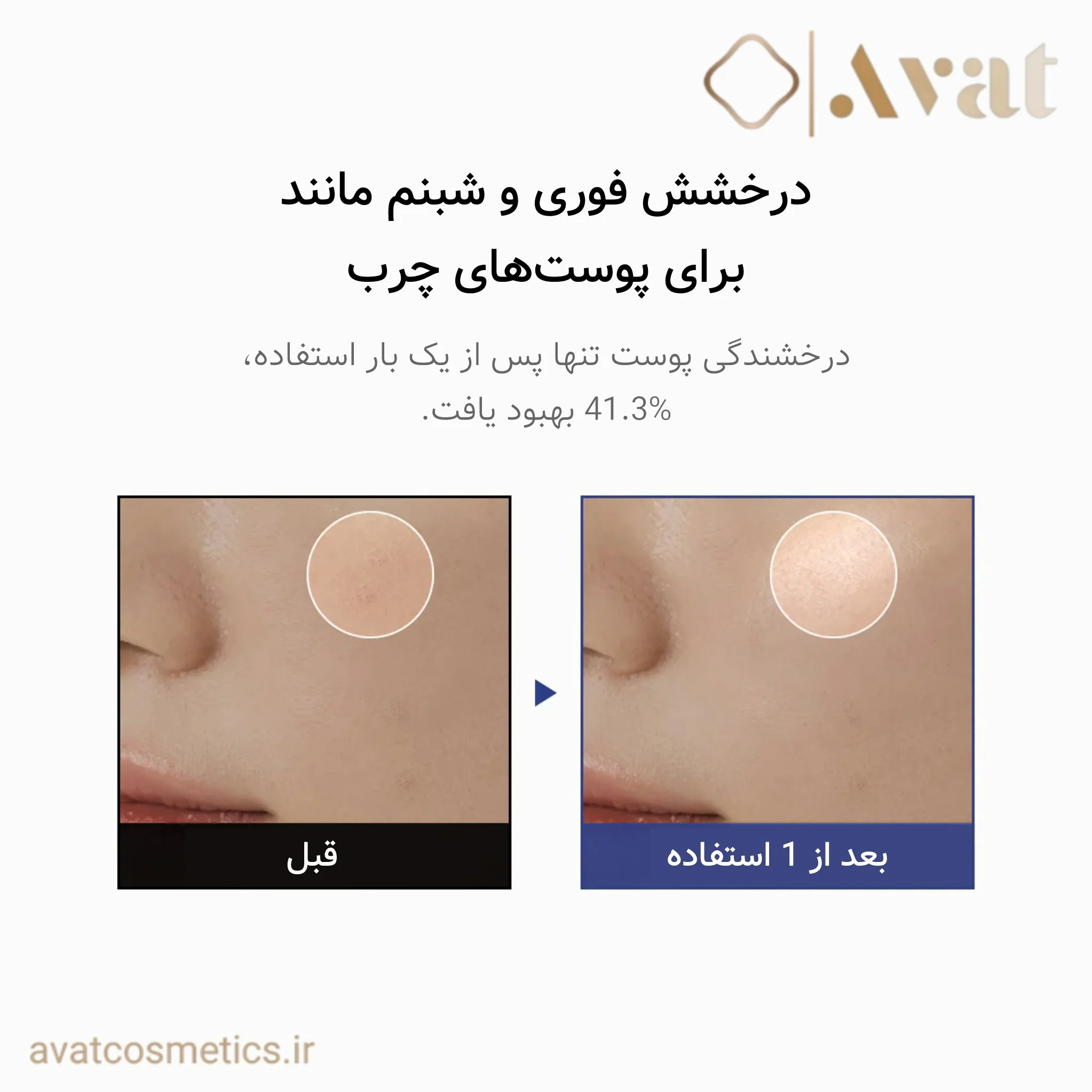 میست ژلی آکوا مارین دکتر آلتیا