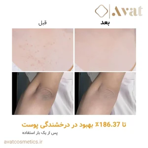 اسپری کوجیک اسید و زردچوبه دکتر ملاکسین