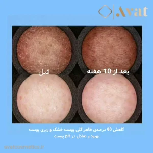 کرم ترمیم کننده تریپل Lipikar Ap لاروش پوزای