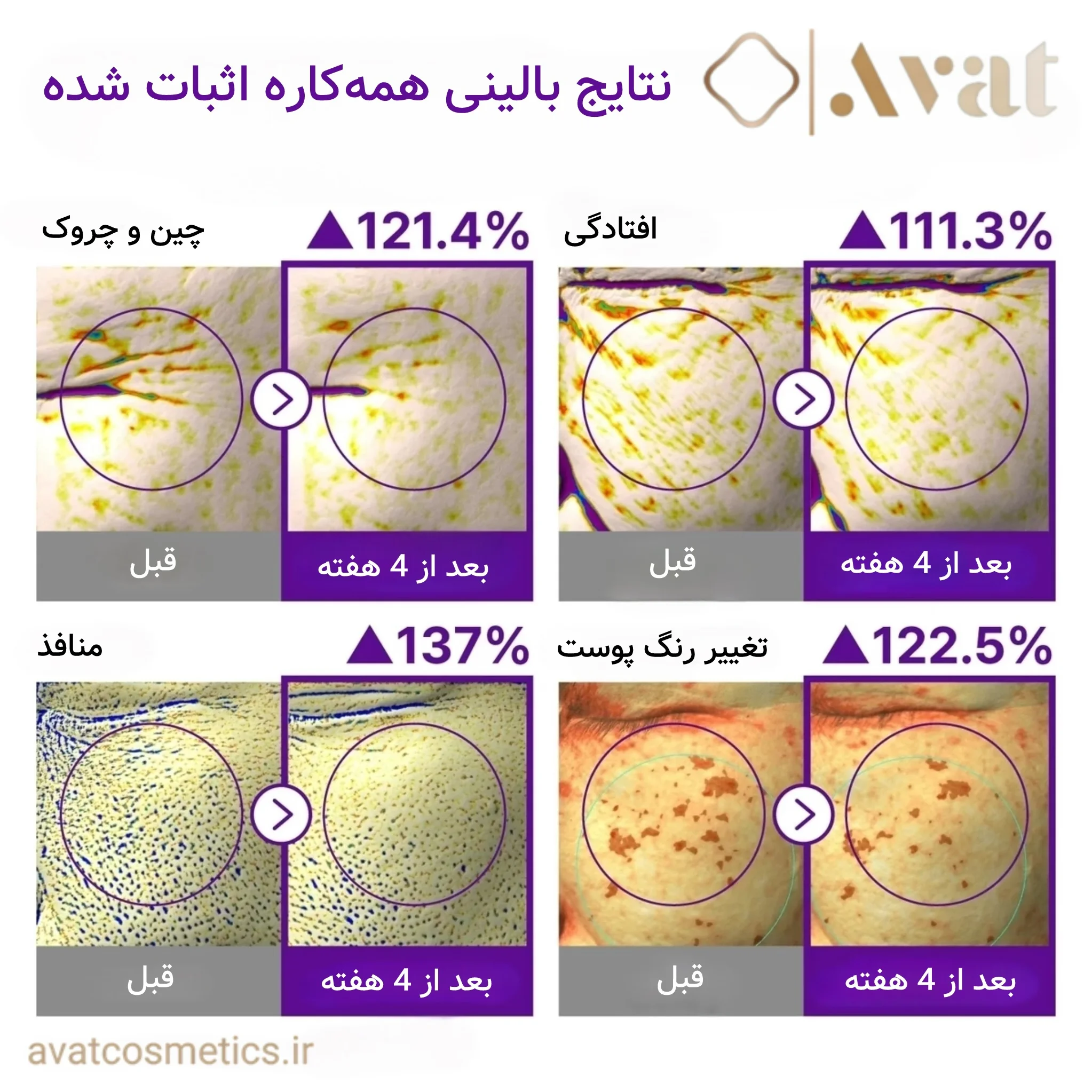 کرم دور چشم NAD و رتینال نامبوزین